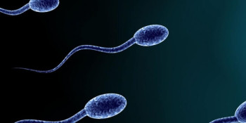 Azoospermia