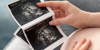 Having a first pregnancy scan following IVF treatment