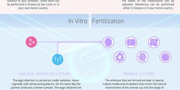 An infographic explaining the process of IVF in a few steps