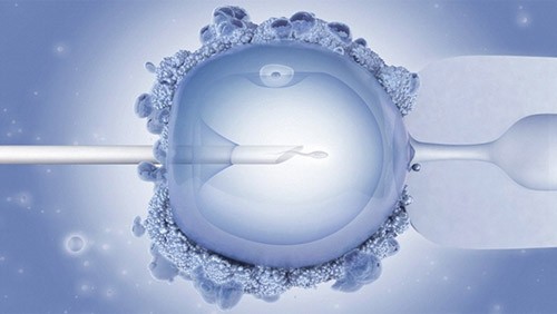 Fertility Treatments ICSI Fertility Treatments ICSI