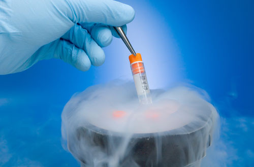 Fertility Treatments Sperm Freezing