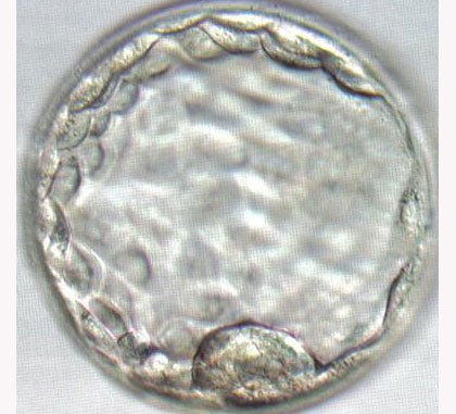 Fertility Treatments Blastocyst Fertility Treatments Blastocyst