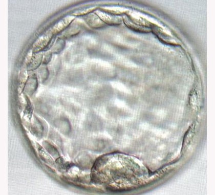 Fertility Treatments Blastocyst